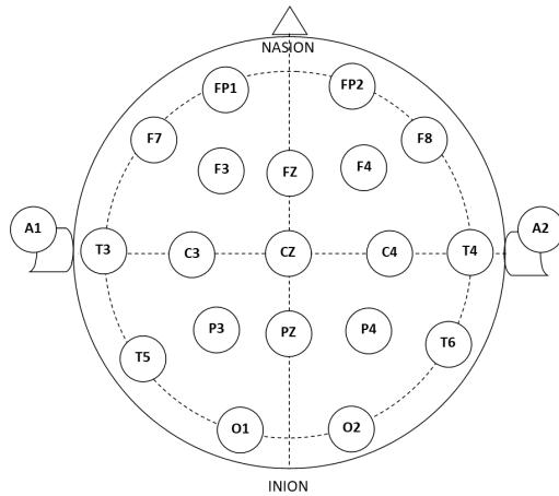 A figure from Automatic detection of abnormal EEG signals using wavelet feature extraction and gradient boosting decision tree