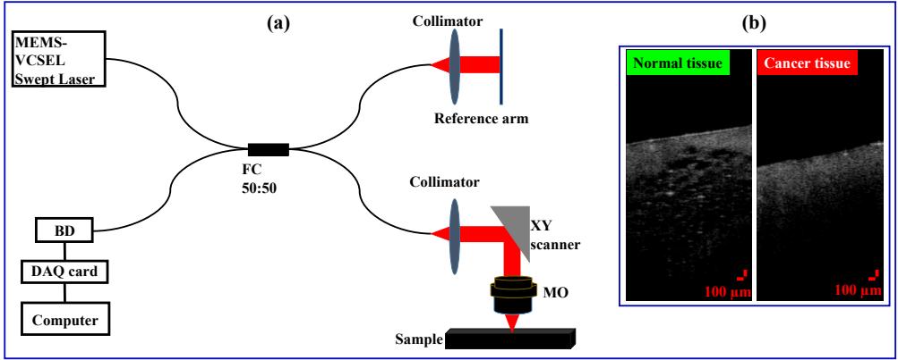 A figure from Deep learning architecture “LightOCT” for diagnostic decision support using optical coherence tomography images of biological samples