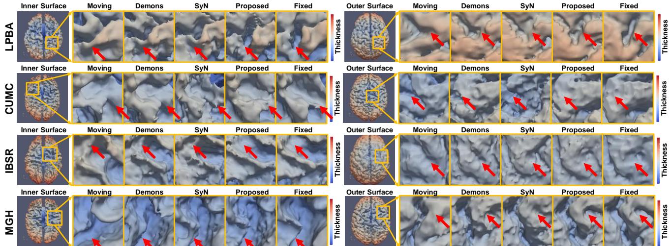 A figure from Deep morphological simplification network (MS-Net) for guided registration of brain magnetic resonance images