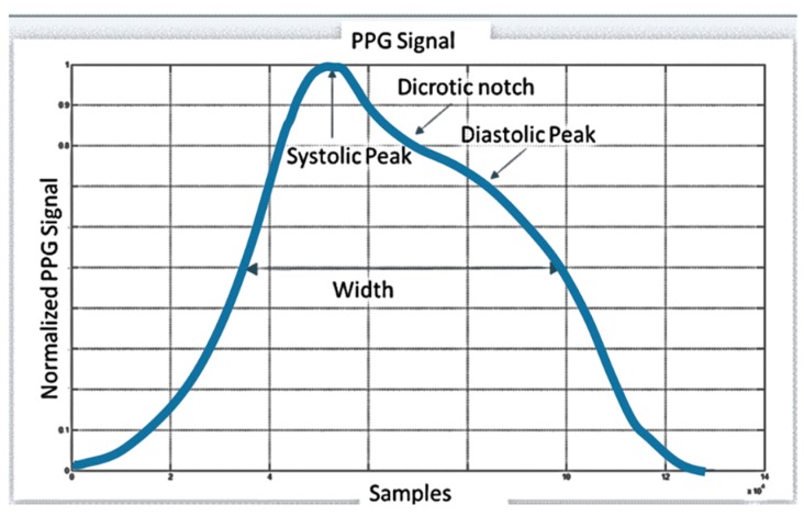 A figure from An Advanced Bio-Inspired PhotoPlethysmoGraphy (PPG) and ECG Pattern Recognition System for Medical Assessment