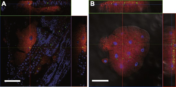 A figure from A metagenomic approach from aphid’s hemolymph sheds light on the potential roles of co-existing endosymbionts