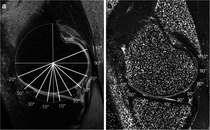 A figure from Fat-suppressed T2 mapping of human knee femoral articular cartilage: comparison with conventional T2 mapping
