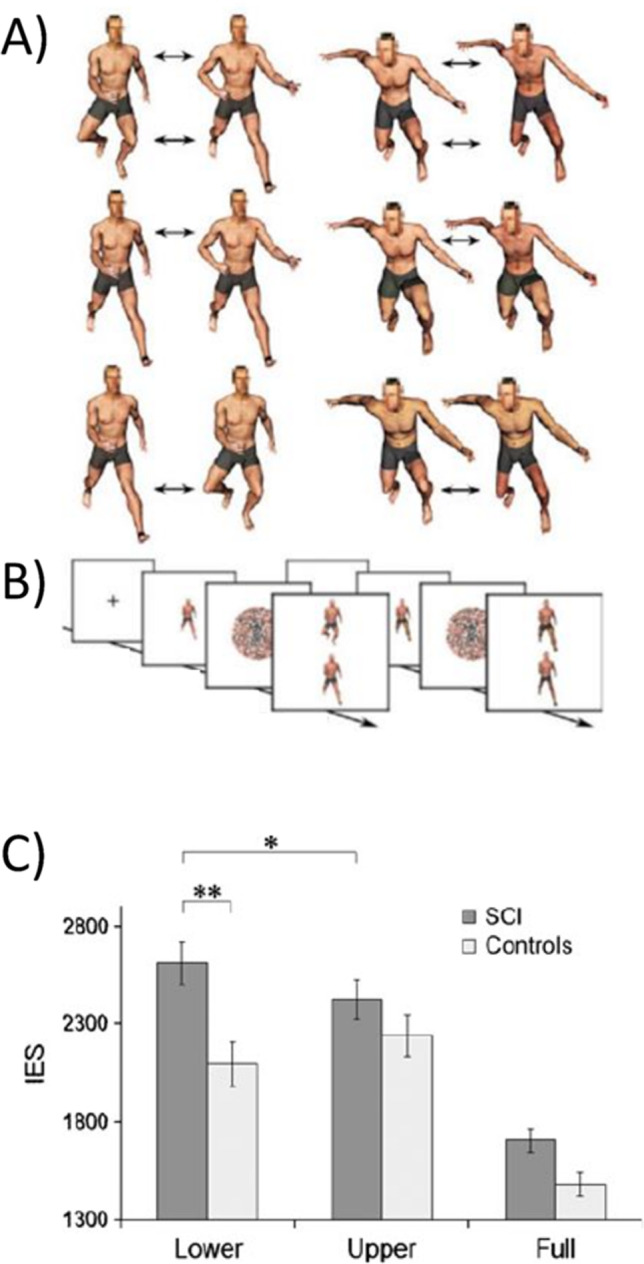 A figure from What the study of spinal cord injured patients can tell us about the significance of the body in cognition