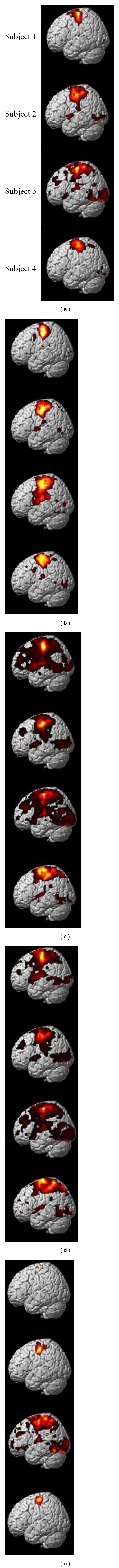 A figure from Functional Magnetic Resonance Imaging for Imaging Neural Activity in the Human Brain: The Annual Progress