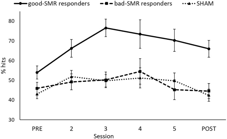 A figure from Self-Regulation of SMR Power Led to an Enhancement of Functional Connectivity of Somatomotor Cortices in Fibromyalgia Patients