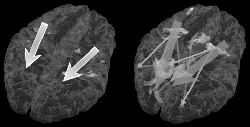 A figure from Traveling EEG slow oscillation along the dorsal attention network initiates spontaneous perceptual switching