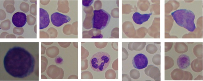 A figure from Efficient Classification of White Blood Cell Leukemia with Improved Swarm Optimization of Deep Features