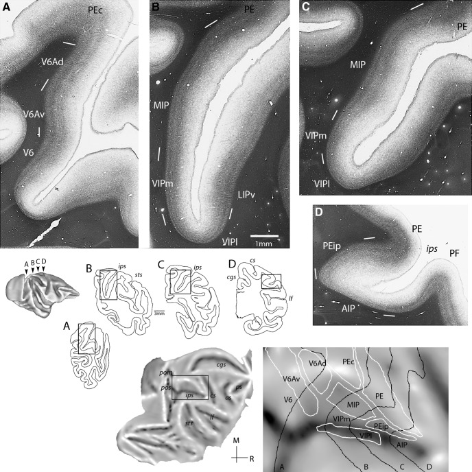 A figure from Cortical Afferents and Myeloarchitecture Distinguish the Medial Intraparietal Area (MIP) from Neighboring Subdivisions of the Macaque Cortex Connections of Macaque Medial Intraparietal Sulcus