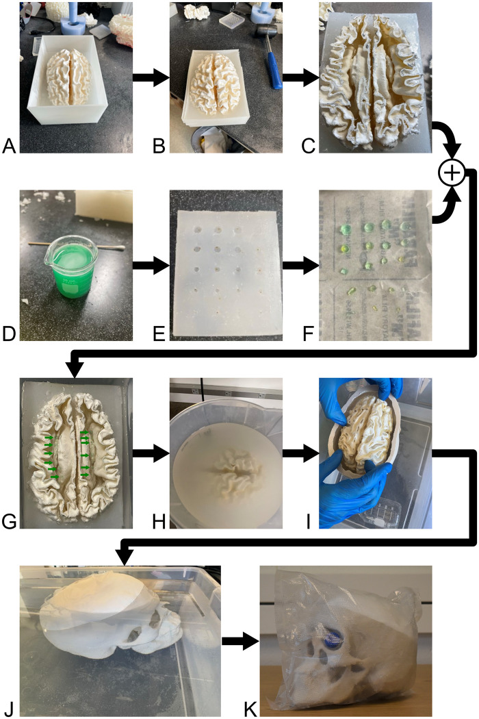 A figure from Towards a barrier-free anthropomorphic brain phantom for quantitative magnetic resonance imaging: Design, first construction attempt, and challenges MRI brain phantom