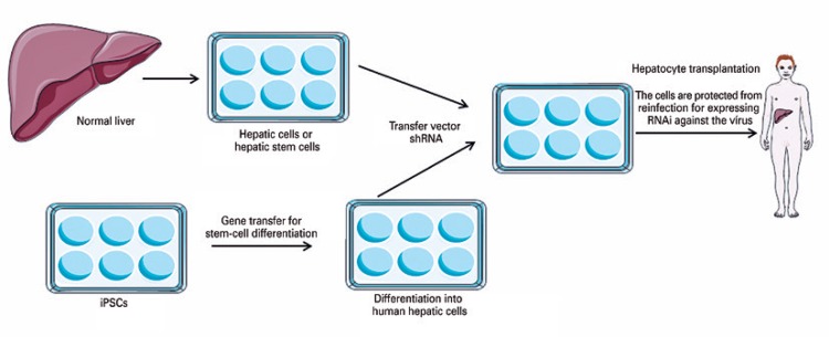 A figure from Gene therapy: advances, challenges and perspectives Terapia gênica: avanços, desafios e perspectivas