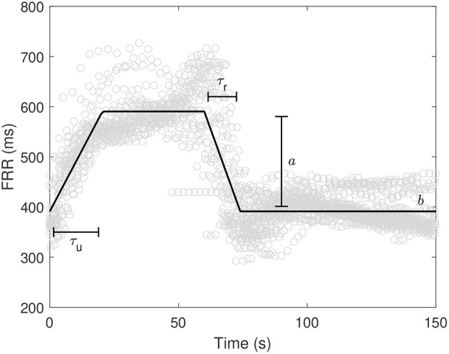A figure from Relationship Between Deceleration Morphology and Phase Rectified Signal Averaging-Based Parameters During Labor