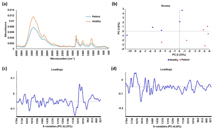 A figure from Fourier Transform Infrared Spectroscopy as a Cancer Screening and Diagnostic Tool: A Review and Prospects
