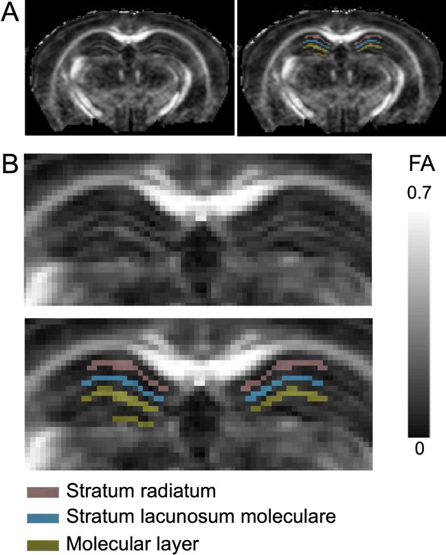 A figure from High B-value diffusion tensor imaging for early detection of hippocampal microstructural alteration in a mouse model of multiple sclerosis