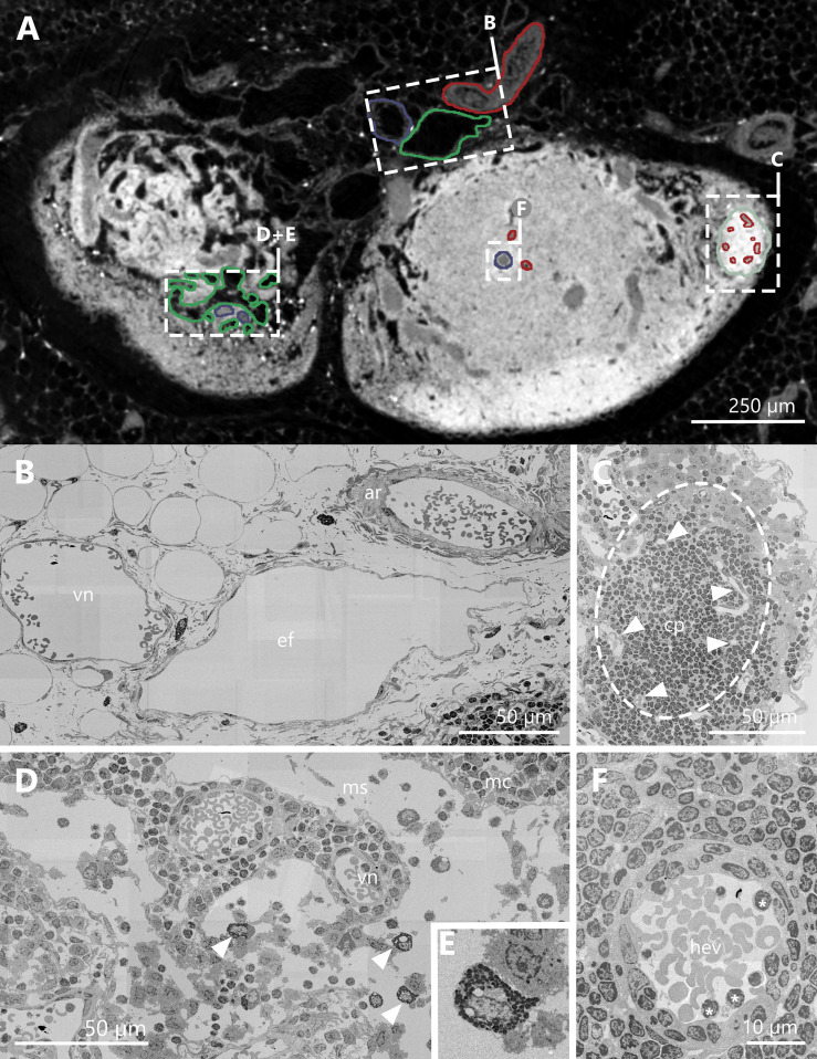 A figure from Three-dimensional analyses of vascular network morphology in a murine lymph node by X-ray phase-contrast tomography with a 2D Talbot array