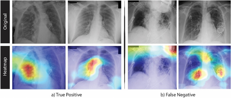 A figure from EpistoNet: an ensemble of Epistocracy-optimized mixture of experts for detecting COVID-19 on chest X-ray images