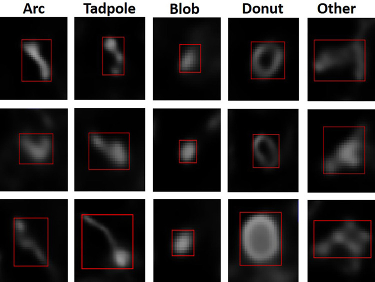 A figure from Machine learning based classification of mitochondrial morphologies from fluorescence microscopy images of Toxoplasma <i> gondii </i> cysts Automatic classification of mitochondrial shapes
