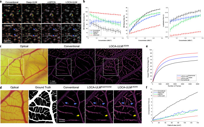 A figure from Context-aware deep learning enables high-efficacy localization of high concentration microbubbles for super-resolution ultrasound localization microscopy