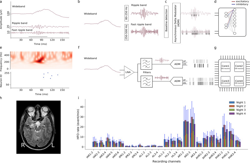 A figure from An electronic neuromorphic system for real-time detection of high frequency oscillations (HFO) in intracranial EEG