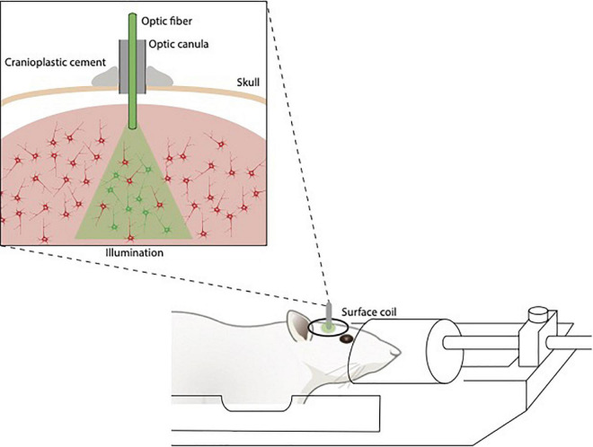 A figure from Combining magnetic resonance imaging with readout and/or perturbation of neural activity in animal models: Advantages and pitfalls