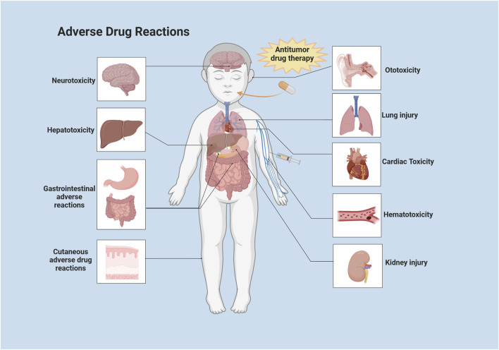 A figure from Anticancer therapy-induced adverse drug reactions in children and preventive and control measures Yan et al. 10.3389/fphar.2024.1329220