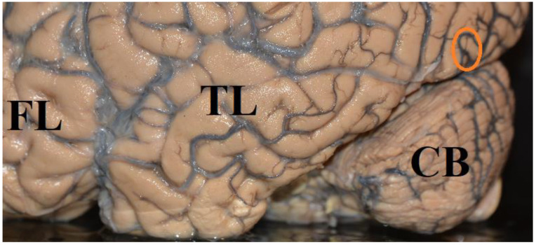 A figure from A Scientific Approach to Conscious Experience, Introspection, and Unconscious Processing: Vision and Blindsight