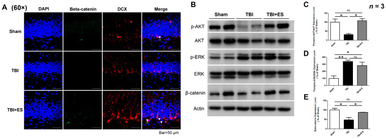 A figure from Short-Term Cortical Electrical Stimulation during the Acute Stage of Traumatic Brain Injury Improves Functional Recovery