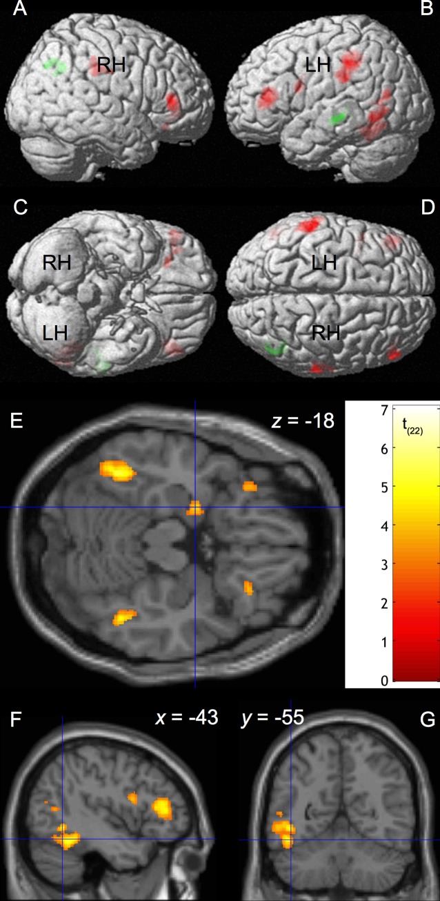 A figure from The Magical Activation of Left Amygdala when Reading Harry Potter: An fMRI Study on How Descriptions of Supra-Natural Events Entertain and Enchant fMRI Study on Supra-Natural Effects