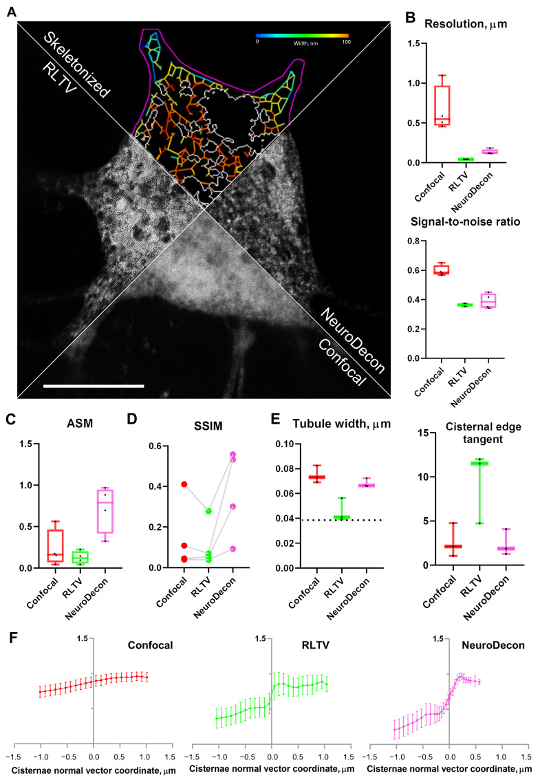 A figure from NeuroDecon: A Neural Network-Based Method for Three-Dimensional Deconvolution of Fluorescent Microscopic Images