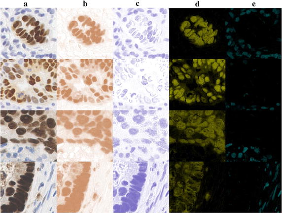 A figure from Statistical colour models: an automated digital image analysis method for quantification of histological biomarkers