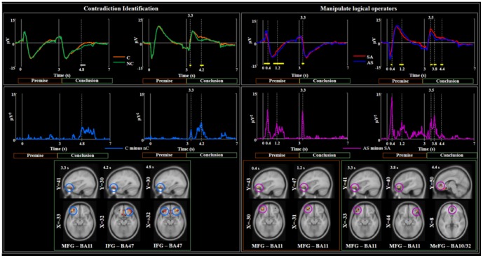 A figure from Contradictory Reasoning Network: An EEG and fMRI Study Contradictory Reasoning Investigated by EEG & fMRI