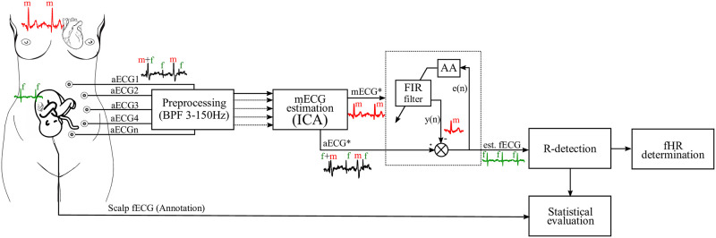 A figure from Optimization of adaptive filter control parameters for non-invasive fetal electrocardiogram extraction Optimization of adaptive filter control parameters for non-invasive fetal electrocardiogram extraction
