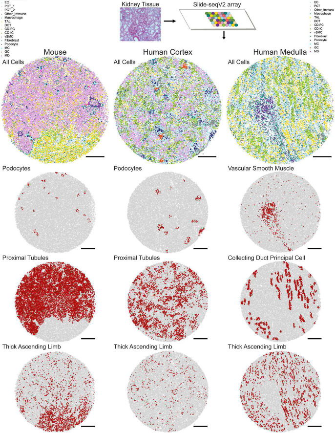 A figure from Principles of Spatial Transcriptomics Analysis: A Practical Walk-Through in Kidney Tissue