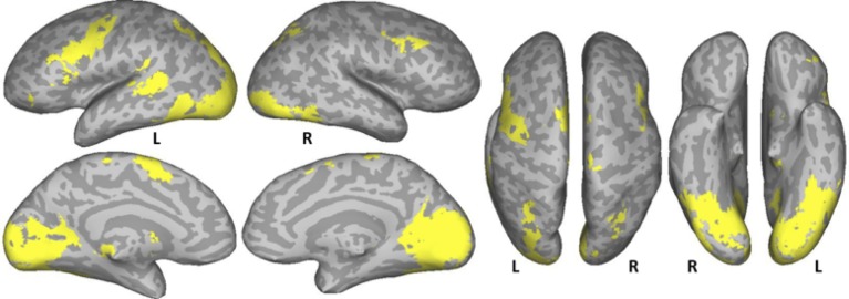 A figure from The neural substrates of natural reading: a comparison of normal and nonword text using eyetracking and fMRI