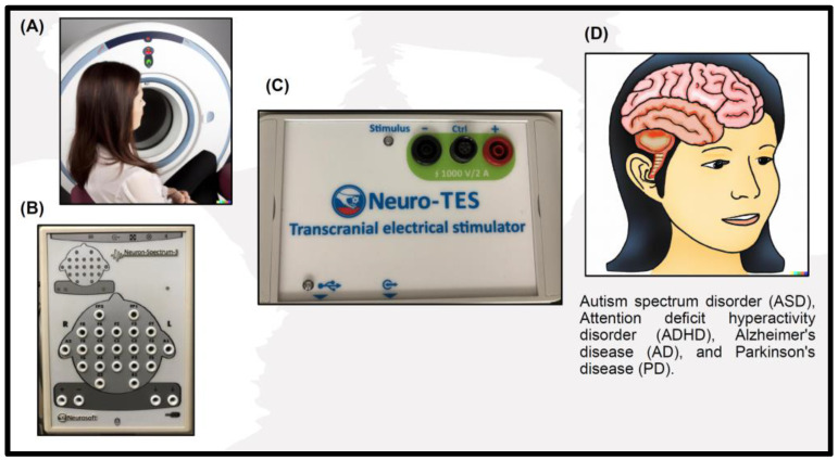 A figure from Exploring the Frontiers of Neuroimaging: A Review of Recent Advances in Understanding Brain Functioning and Disorders