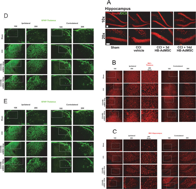 A figure from Human adipose-derived mesenchymal stem cells for acute and sub-acute TBI Human adipose-derived mesenchymal stem cells for acute and sub-acute TBI