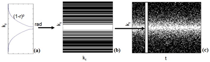 A figure from Comparison of Total Variation with a Motion Estimation Based Compressed Sensing Approach for Self-Gated Cardiac Cine MRI in Small Animal Studies A Compressed Sensing Approach Using B-Spline Motion Estimation