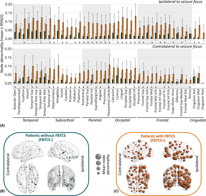 A figure from Focal to bilateral tonic–clonic seizures are associated with widespread network abnormality in temporal lobe epilepsy SINHA et al.