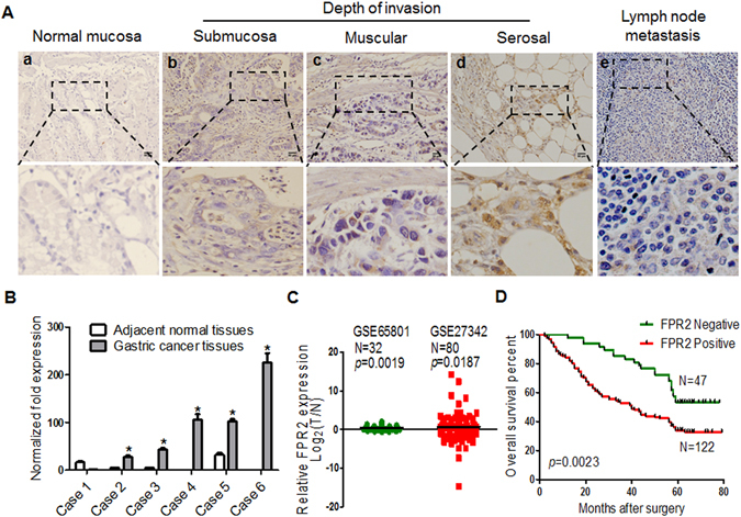 A figure from FPR2 promotes invasion and metastasis of gastric cancer cells and predicts the prognosis of patients