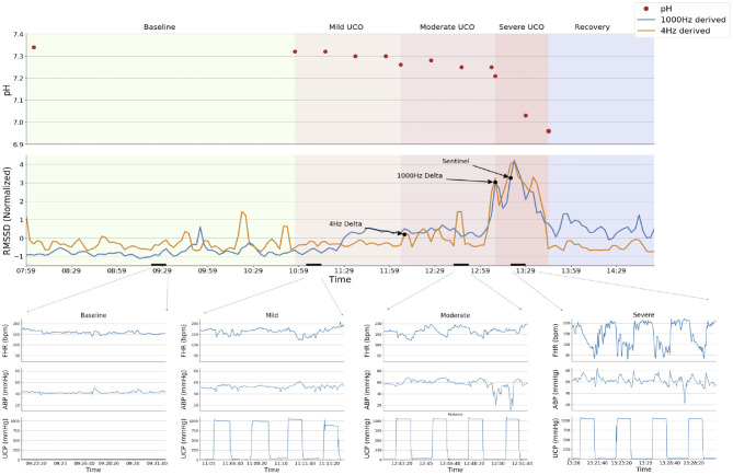A figure from Fetal Cardiovascular Decompensation During Labor Predicted From the Individual Heart Rate Tracing: A Machine Learning Approach in Near-Term Fetal Sheep Model