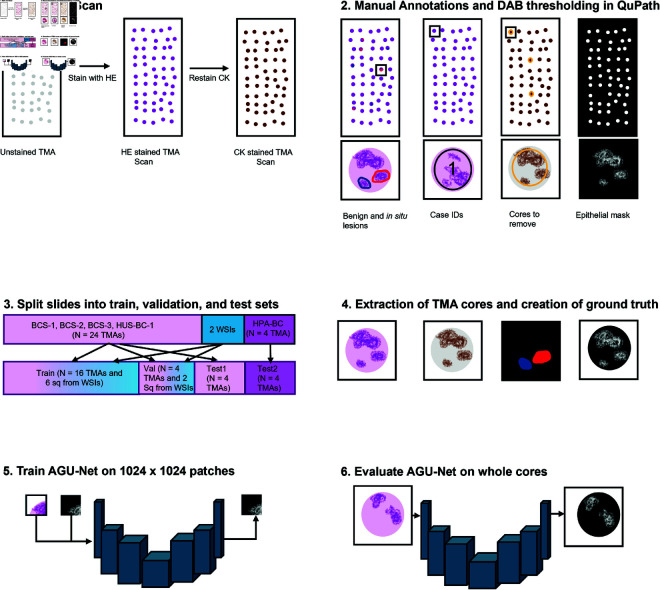 A figure from Immunohistochemistry guided segmentation of benign epithelial cells, <i> in situ </i> lesions, and invasive epithelial cells in breast cancer slides IHC guided segmentation of benign, <i> in situ </i> , and invasive epithelial cells in breast cancer slides
