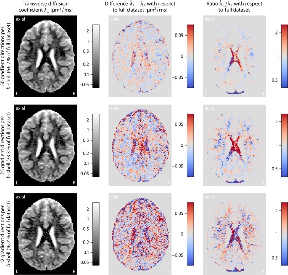 A figure from Quantitative mapping of the per‐axon diffusion coefficients in brain white matter Quantitative Mapping of the Per‐Axon Diffusion Coefficients Kaden et al.