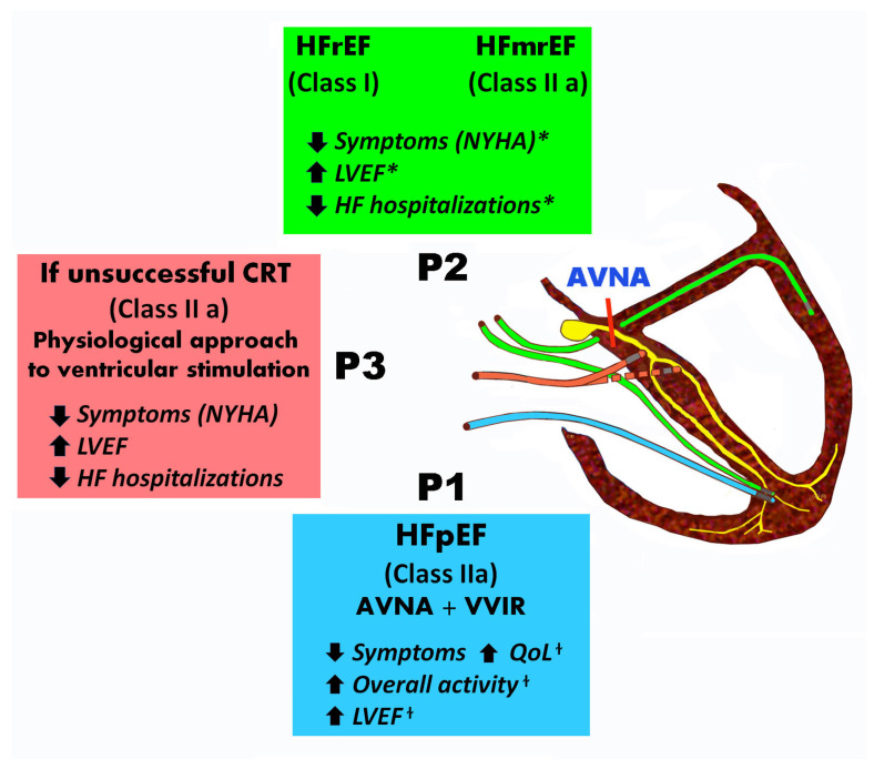 A figure from Outcomes of Atrioventricular Node Ablation and Pacing in Patients with Heart Failure and Atrial Fibrillation: From Cardiac Resynchronization Therapy to His Bundle Pacing