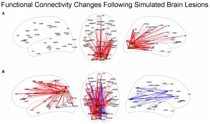 A figure from Interpreting the effects of altered brain anatomical connectivity on fMRI functional connectivity: a role for computational neural modeling