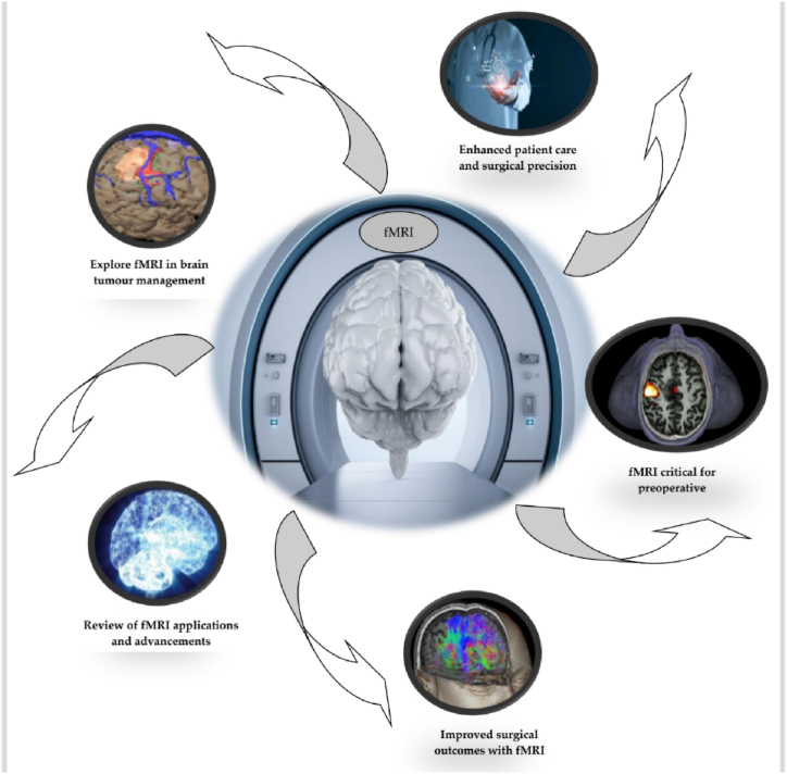 A figure from Systematic review of functional magnetic resonance imaging (fMRI) applications in the preoperative planning and treatment assessment of brain tumors